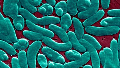 ‘Flesh-Eating’ Bacteria Cases Are on the Rise Along the Gulf Coast. How Do You Get It, and How Can You Protect Yourself?