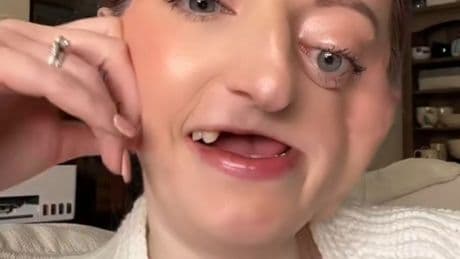 Doctors blamed Nicola’s ‘nagging toothache’ on a sinus infection – it stole her smile, half her face and her life