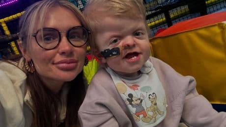 Aaron Chalmers’ son may need wheelchair as ex cries over heartbreaking health condition