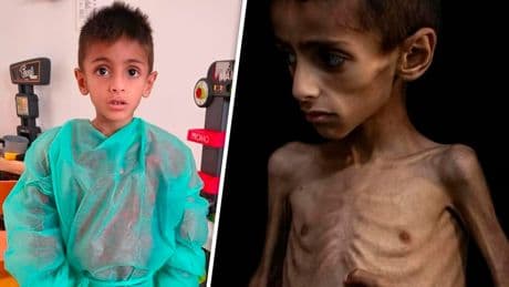 Osama (5) in Klinik in Italien - „Sein Zustand hatte mit der Situation in Gaza nichts zu tun“