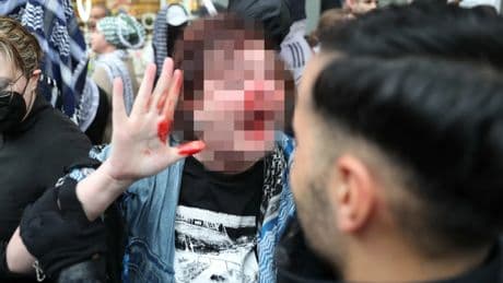 Palästina-Demo in Berlin: Polizist schlägt Frau: Irische Botschaft äußert Besorgnis