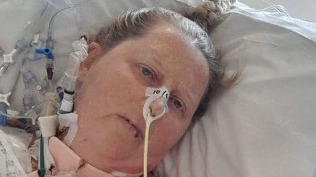 NHS transplant waiting list reaches record high as patients stuck in 'limbo'