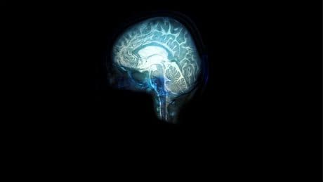 Psychosurgery is back. But these are not the ice-pick-through-the-eye-socket lobotomies of the past