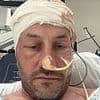 I thought I had a common hangover symptom - it was actually TWO deadly brain tumours
