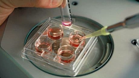 « Je vais avoir 37 ans, j’ai eu de la chance » : les galères de l’autoconservation des ovocytes