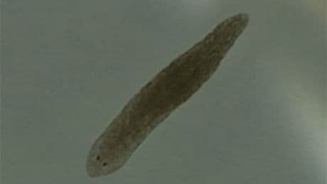 Tiny worms found in ponds and river could help treat schizophrenia