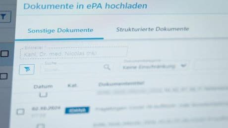 Digitalisierung: Lauterbach bestätigt Sicherheitslücke bei E-Patientenakte