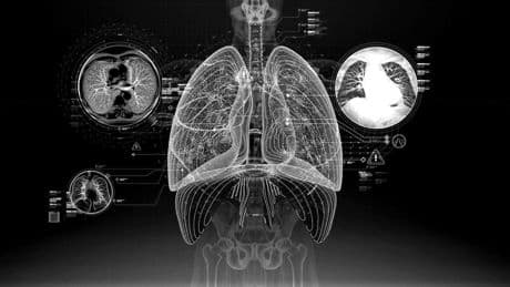 Sanidad e inteligencia artificial: el camino hacia una superinteligencia médica