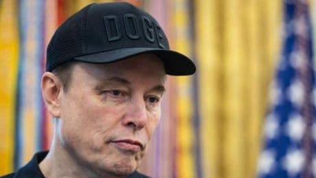 Gözündeki morluk dikkat çekmişti: Elon Musk'ın yüzüne ne oldu?