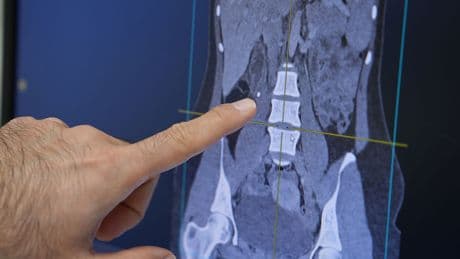 ‘Obezite, cep telefonu, stres kısırlığın başlıca sebepleri’