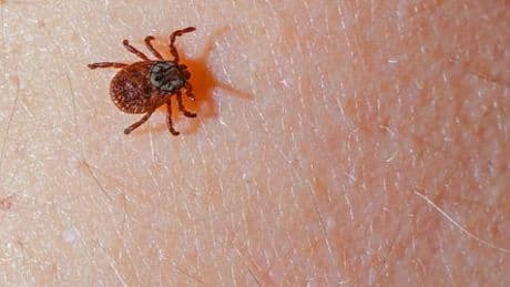 Infektion durch Zecken: Was Sie über Borreliose wissen müssen