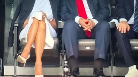 La Casa Bianca: Trump ha insufficienza venosa cronica. Ecco il perché delle gambe gonfie