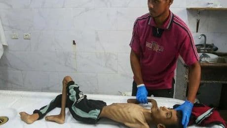 Gaza, el infierno es un saco de huesos