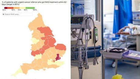How long are cancer treatment waits in YOUR area? With just half of cases are being diagnosed on time, our tracker reveals the worst-hit spots