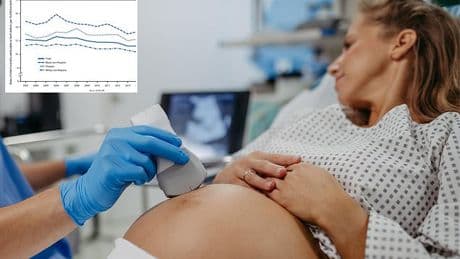 Experts issue warning as up to 53million Americans lead lifestyle that can raise risk of birth defects