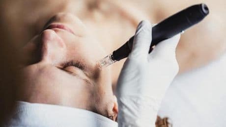 Dermapen Nedir, Ne İşe Yarar? Dermapen Tedavisi Nasıl Uygulanır?