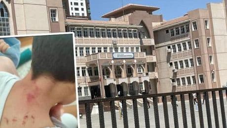 Şanlıurfa'da 10 yaşındaki öğrencisini döven öğretmen tutuklandı