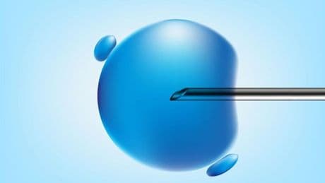 Ocho bebés nacen sin una enfermedad hereditaria gracias a la donación de ADN