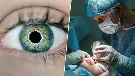 Sin láseres, sin cortes y en un minuto: la nueva técnica revolucionaria para decir adiós definitivamente a las gafas