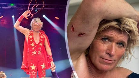 Zwaard doorboort arm Hans Klok: ’Ik zat vast, als een kip aan het spit’