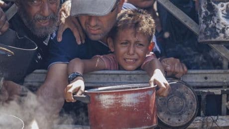 Once nuevos muertos en Gaza por desnutrición elevan a 300 el total de fallecidos de hambre