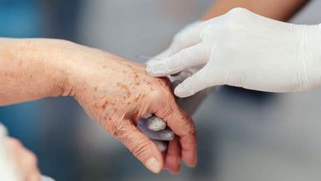 SONDAGE EXCLUSIF. 74 % des médecins sont favorables à l’aide active à mourir