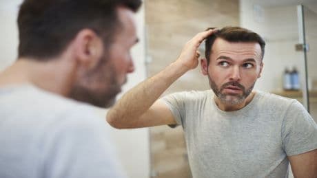 Studie schockt: Dieses beliebte Getränk fördert Haarausfall bei Männern