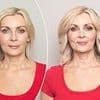 Miracle microdosing trick celebrities use to get thicker hair revealed. This is how I plumped up my volume and length - and it's guaranteed to work for every woman, says ALICE SMELLIE
