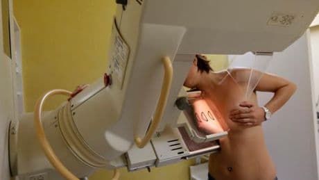 Une nouvelle stratégie fait naître un espoir de guérison pour certains cancers du sein métastatiques