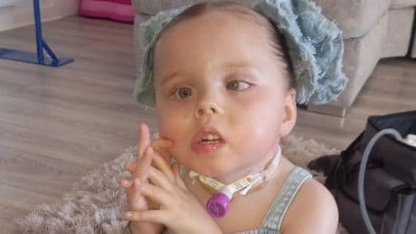 Scots tot who was told illness was 'virus' diagnosed with brain tumour