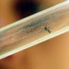 Chikungunya : deux premiers cas autochtones détectés dans les Bouches-du-Rhône, soit six cas désormais en France métropolitaine
