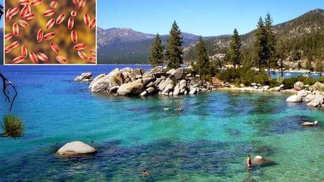 Patient infected with medieval disease after being bitten by a flea in vacation getaway loved by celebrities