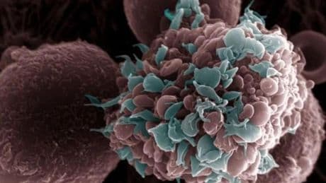 Identifican una nueva proteína para poder prevenir el cáncer de mama