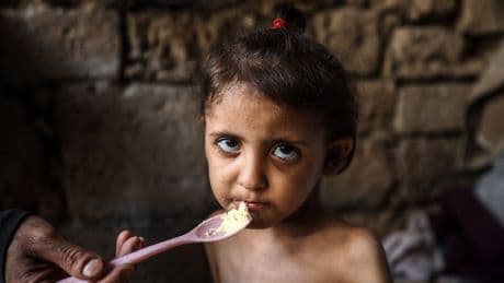 'Let The Children Eat': Israel Is Starving Gaza To Death, Doctors And Experts Warn