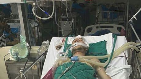Holiday fight at tourist hotspot leaves Brit dad unable to speak and battling for his life