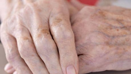 Pflege-Kommission nimmt ihre Arbeit auf: GKV-Spitzenverband mahnt Reform der Pflegeversicherung an