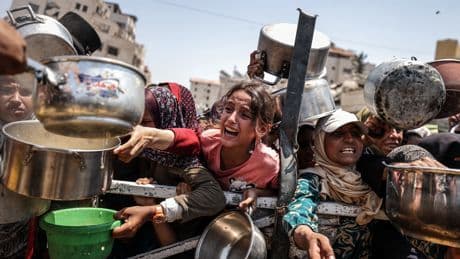 The Malnutrition Crisis in Gaza Will Outlive the War, Experts Warn