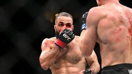 Belal Muhammad’s UFC 315 injuries made clear in gruesome photos