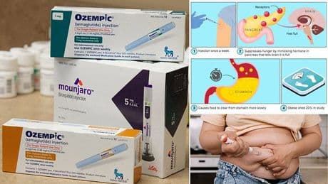 Doctor reveals the best day to inject weight loss jab to avoid calorific bingeing at the weekend
