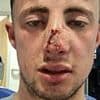 After losing my nine-year-old daughter to epilepsy, my son nearly died when he was beaten up in savage street attack - but the case has been DROPPED by CPS