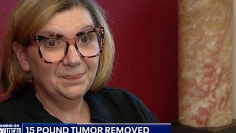 Cancer patient travels 300 miles to have 15 pound tumor removed after doctors at home refuse to operate: ‘Worse than being pregnant’