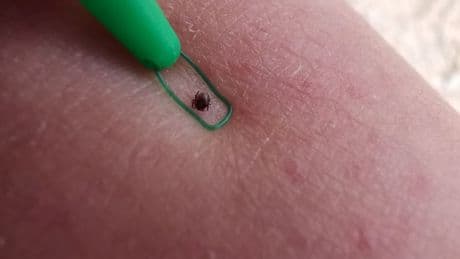 Lyme hastalığı silah olarak mı üretildi? Tartışmalı iddia yeniden gündemde