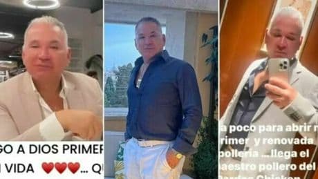 Morta dopo liposuzione a Roma, il chirurgo Picciotti era sotto processo a Brescia. La donna che operò nel 2019: «Usava grappa come anestetico»