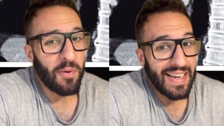 Jorge Martín, médico: ''Algunas personas padecen el fenómeno raro llamado 'disfagia lusoria'. Tienen dificultad para tragar porque una arteria les aprieta el esófago''