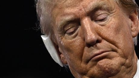 Trump confessed ear injury was ‘not too bad’ at RNC despite wearing oversized bandage, Congressman says