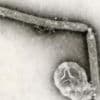 The US hasn't seen a human bird flu case in 3 months. Experts are wondering why