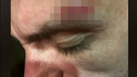 Brit dad-of-two 'beaten up twice inside hotel' during 'nightmare' Turkey holiday