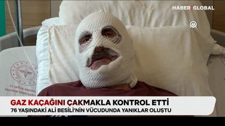 Gaz kaçağını çakmakla kontrol eden adam bu hale geldi