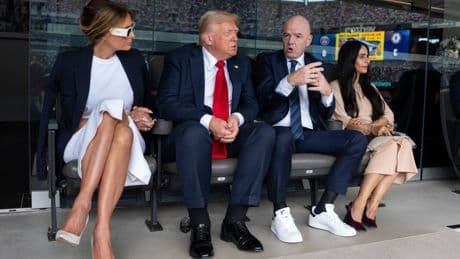 Venenschwäche: Daher kommen Donald Trumps Schwellungen und blaue Flecken