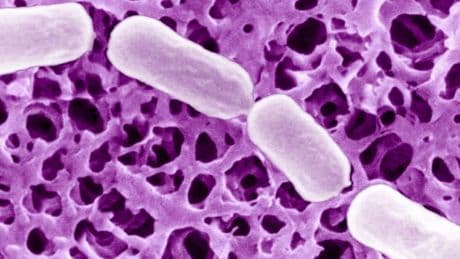 Botulismo: ecco gli alimenti sicuri, le precauzioni e come preparare e conservare cibi e pappe per i bimbi